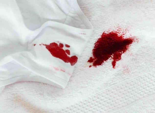 An underwear and towel with period blood stains